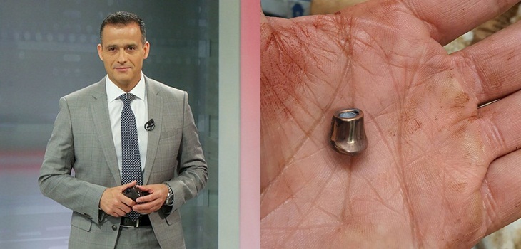 El drámatico relato de Iván Núñez tras ataque que sufrió en Tirúa: 