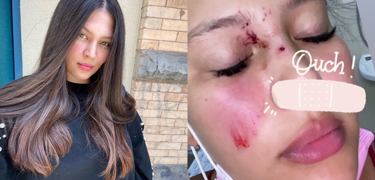 Michelle Carvahlo entregó detalles de su accidente en Brasil: 