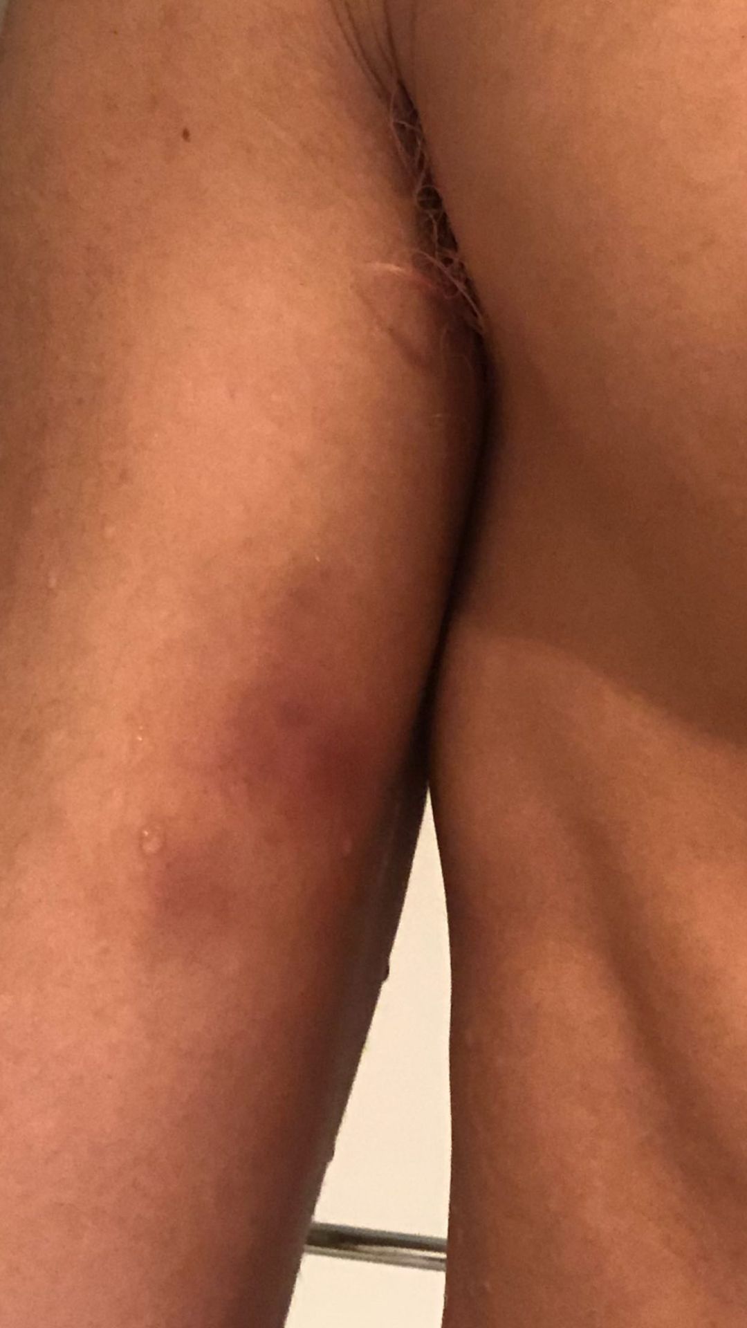 Instagram | Bad Bunny