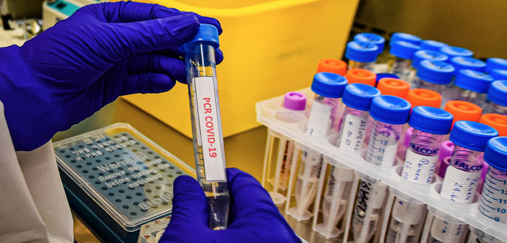 Minsal reportó 3.791 nuevos casos de COVID-19: Maule y Araucanía tienen mayor índice de positividad