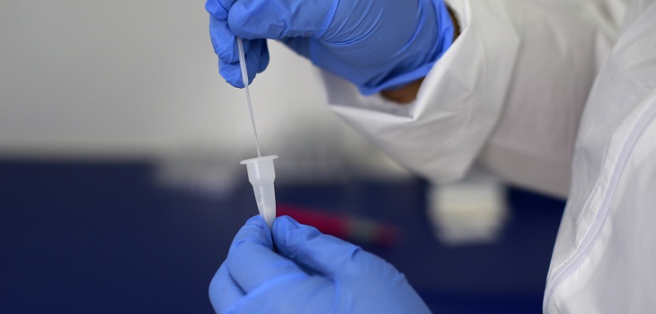 COVID-19: Minsal se abre a informar positividad de test antígenos tras aumento de detección de casos