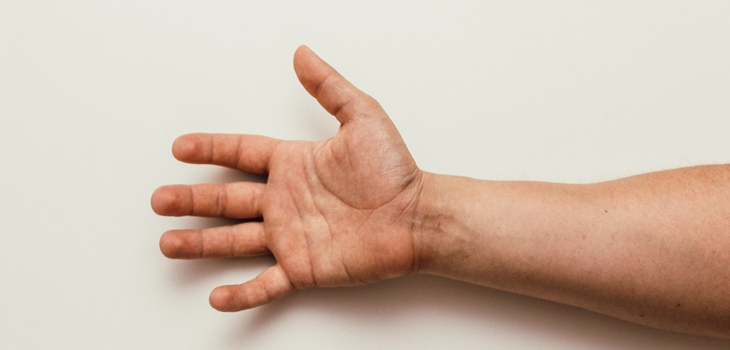 Una simple prueba con el pulgar puede ayudar a indicar un aneurisma aórtico oculto