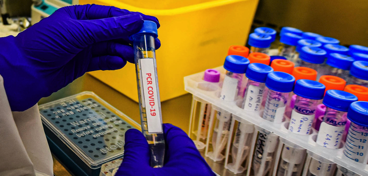 Gobierno confirma segundo caso de variante Delta en el país: es un chileno proveniente de Armenia