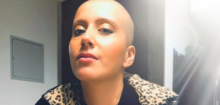 La sincera reflexión de Mila Correa sobre su lucha contra el cáncer: 