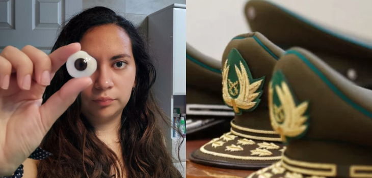 Víctima de trauma ocular cuestionó 