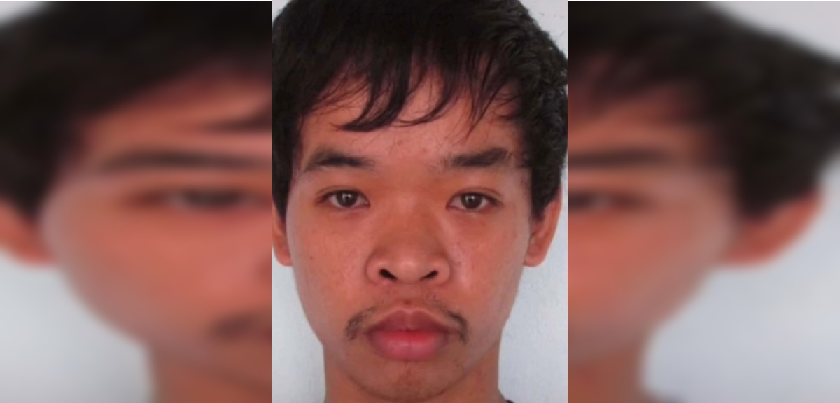 Do Quyen, el joven que al ser rechazado en varios trabajos se operó 9 veces: “No me arrepiento”