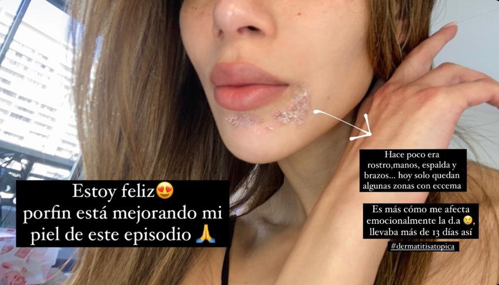 Silvina Varas | Instagram