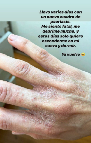 Silvina Varas | Instagram