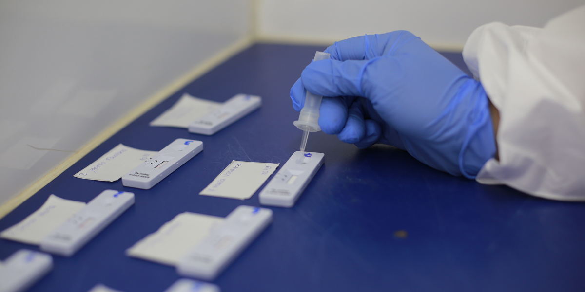 Fonasa anunció cobertura de test rápido de antígenos: examen detecta el COVID-19 en media hora