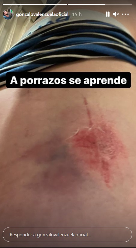 Gonzalo Valenzuela | Instagram