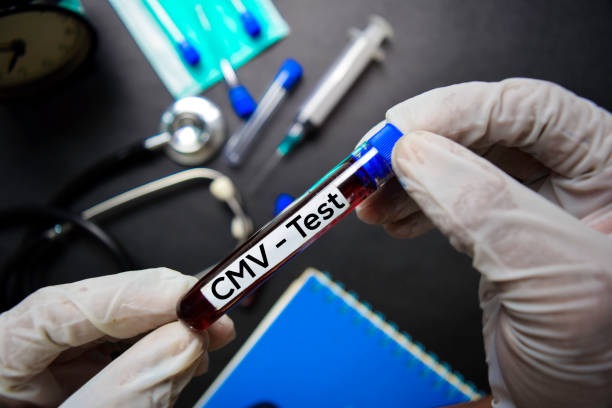 CMV test