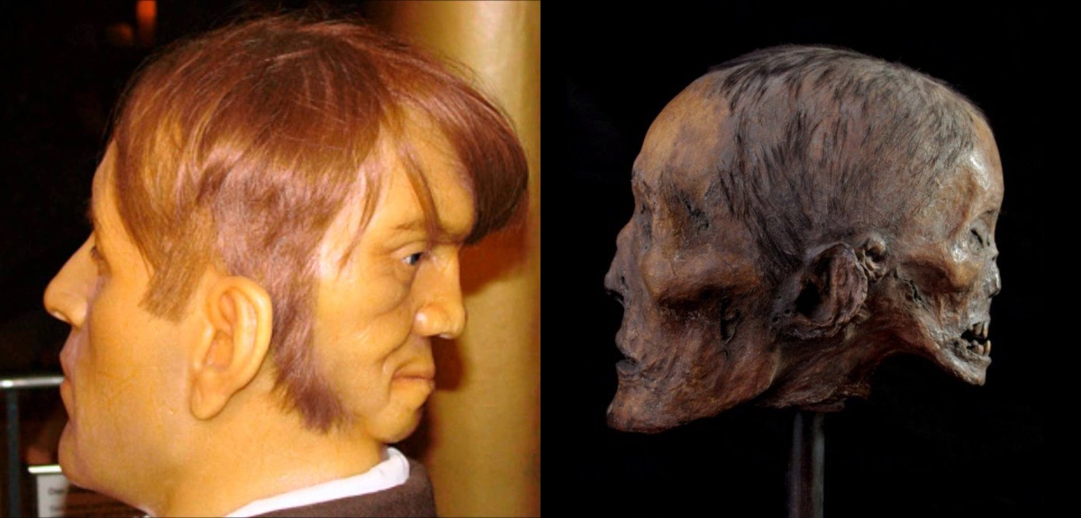 Edward Mordake: la verdad tras el caso del hombre que habría nacido con dos rostros