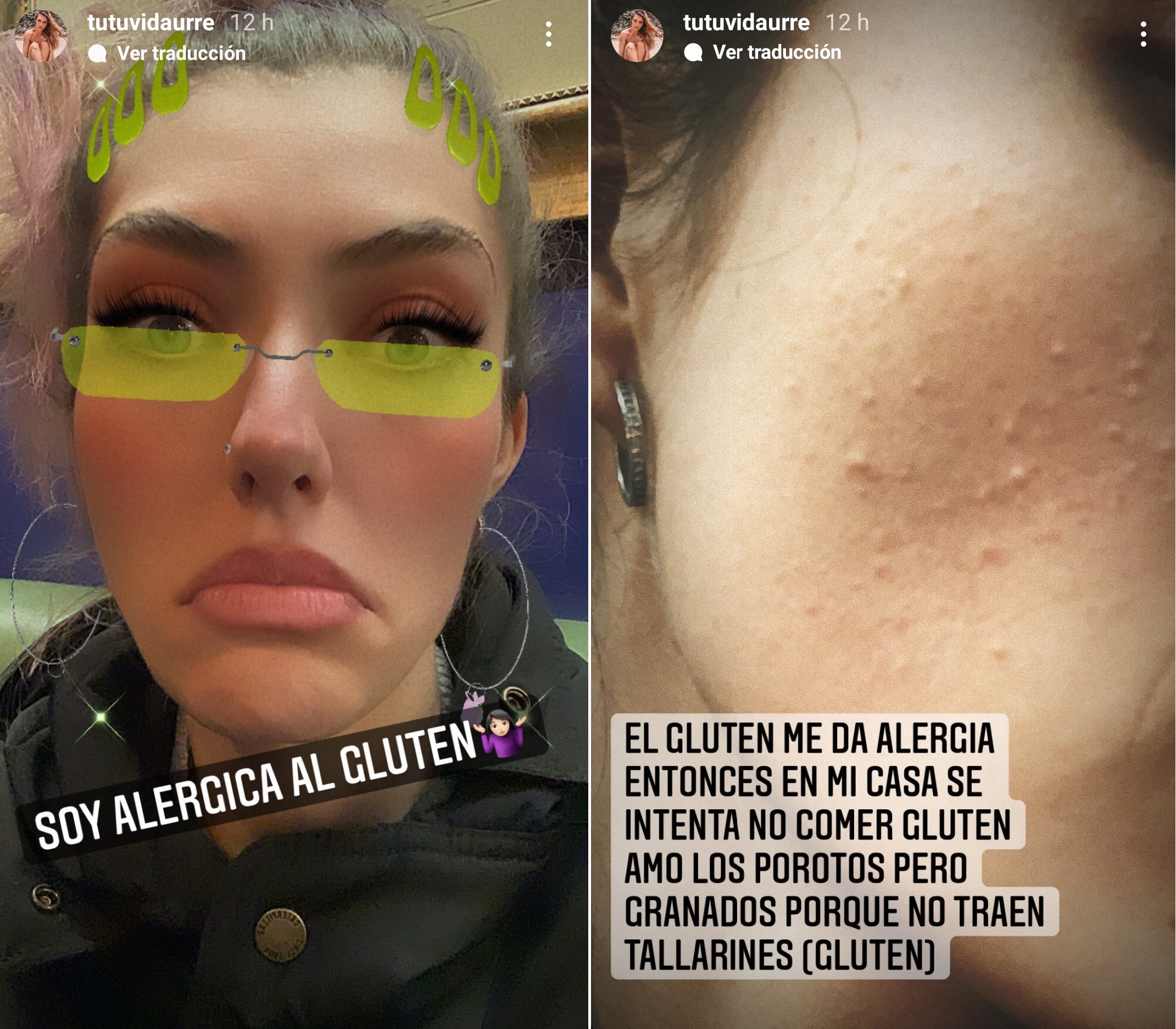 Tutu Vidaurre MasterChef gluten