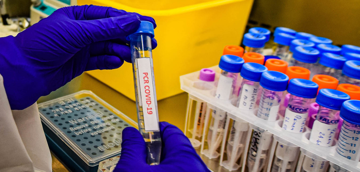 Minsal informó 895 nuevos casos de COVID-19 y positividad en región Metropolitana subió a 2%