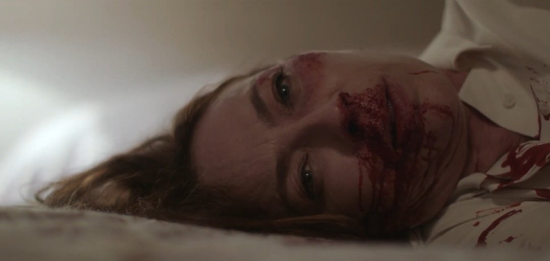 Flavia tras fuerte golpiza de Dante en DementeFlavia tras fuerte golpiza de Dante en Demente