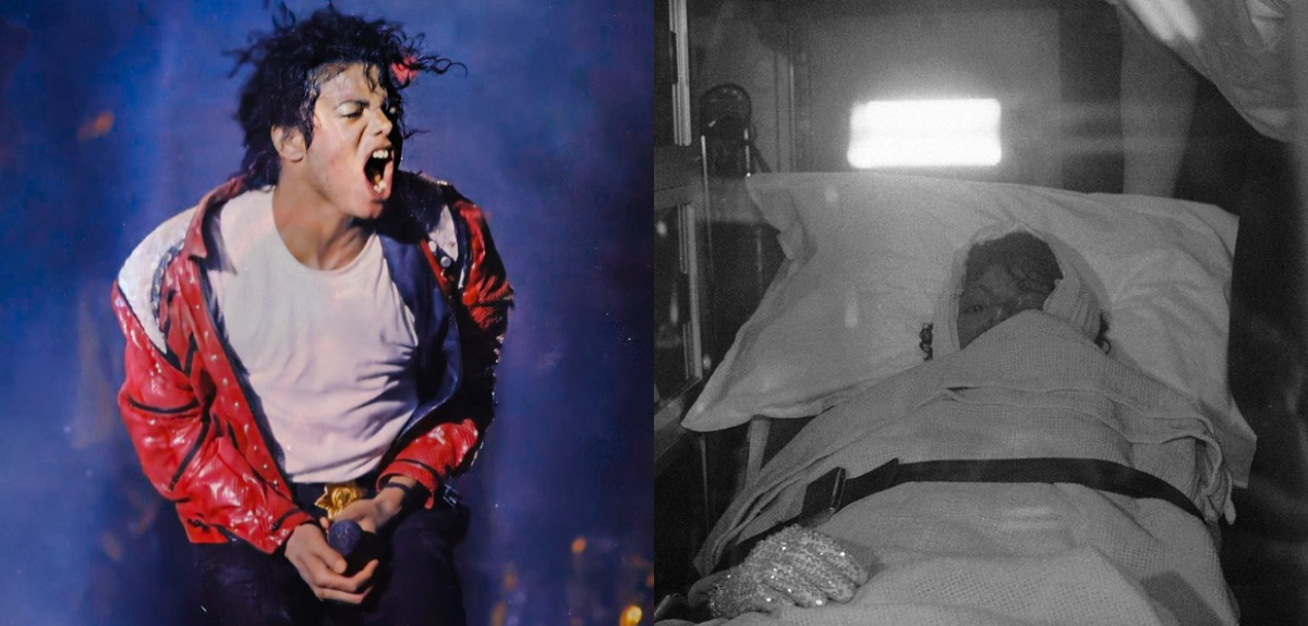 Las consecuencias del accidente que Michael Jackson sufrió en 1984: su cabeza terminó en llamas