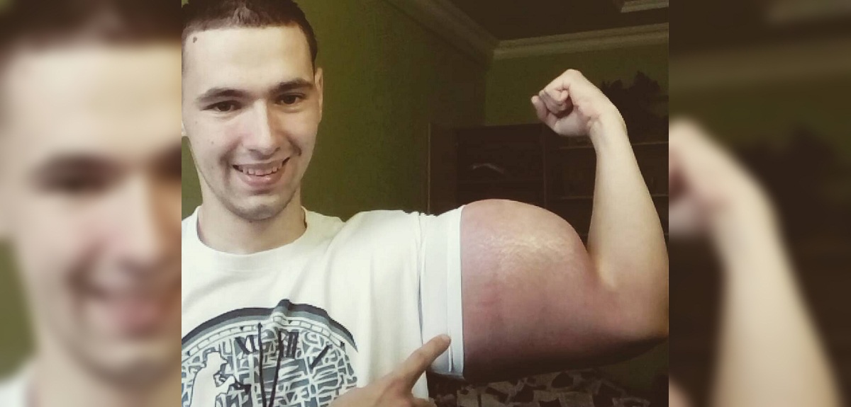 'Popeye ruso' sufrió impactante percance en pleno combate de artes marciales: 