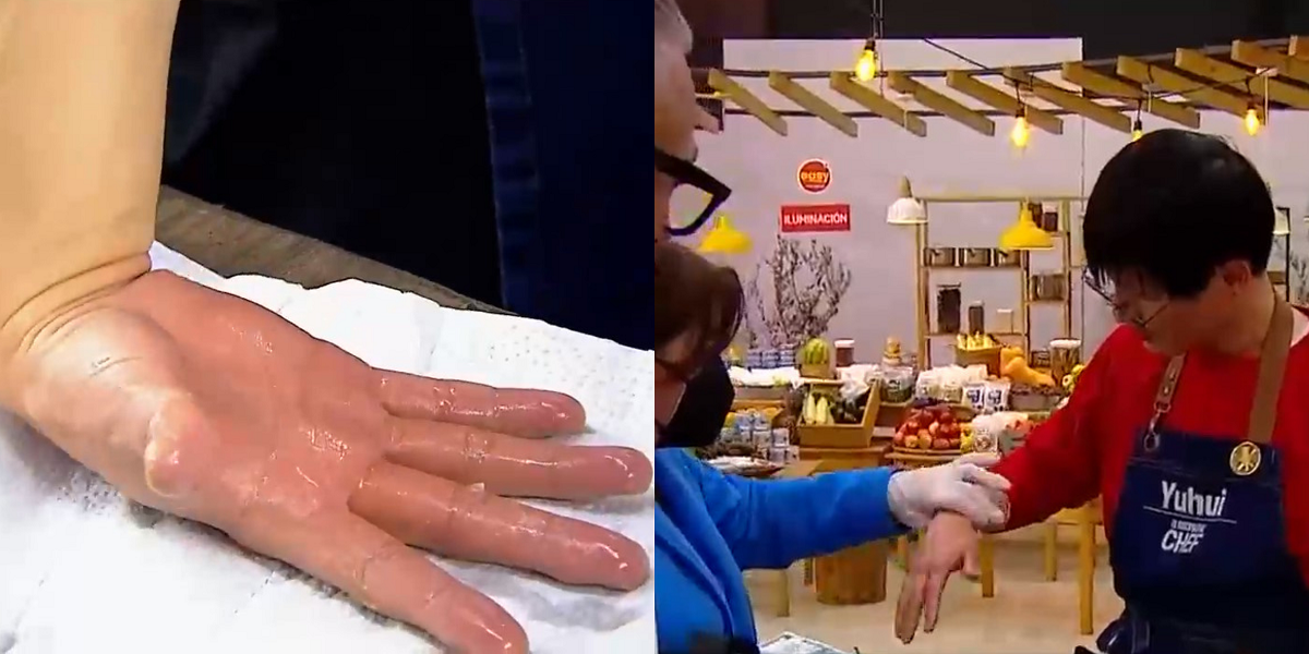 Yuhui protagonizó complejo accidente en ‘El Discípulo del Chef’: aceite le jugó una mala pasada