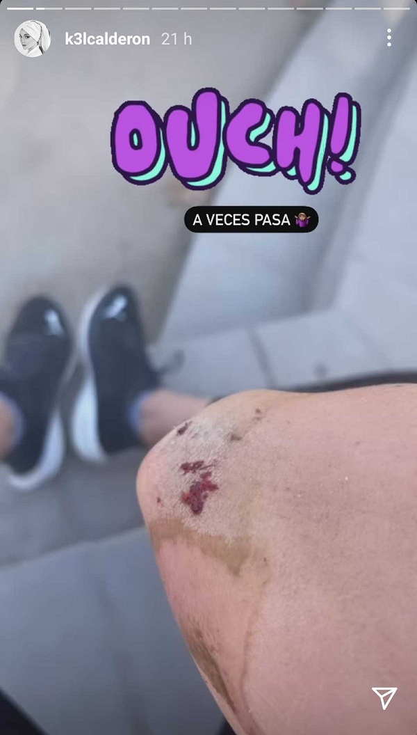 Kel Calderón accidente