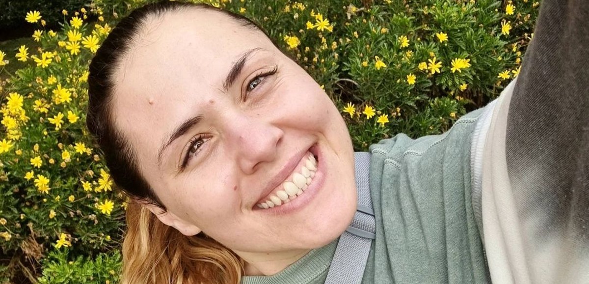 Natalia Duco reveló que se sometió a varios tratamientos estéticos: “Me quiero sentir bonita”