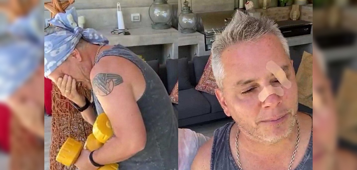 José Miguel Viñuela sufrió accidentado chascarro en pleno Live de Instagram: 