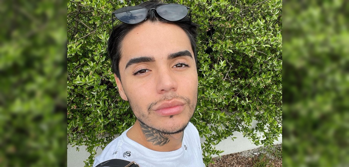 Bichectomía: los efectos y riesgos de la cirugía a la que se sometió Leo Méndez Jr.