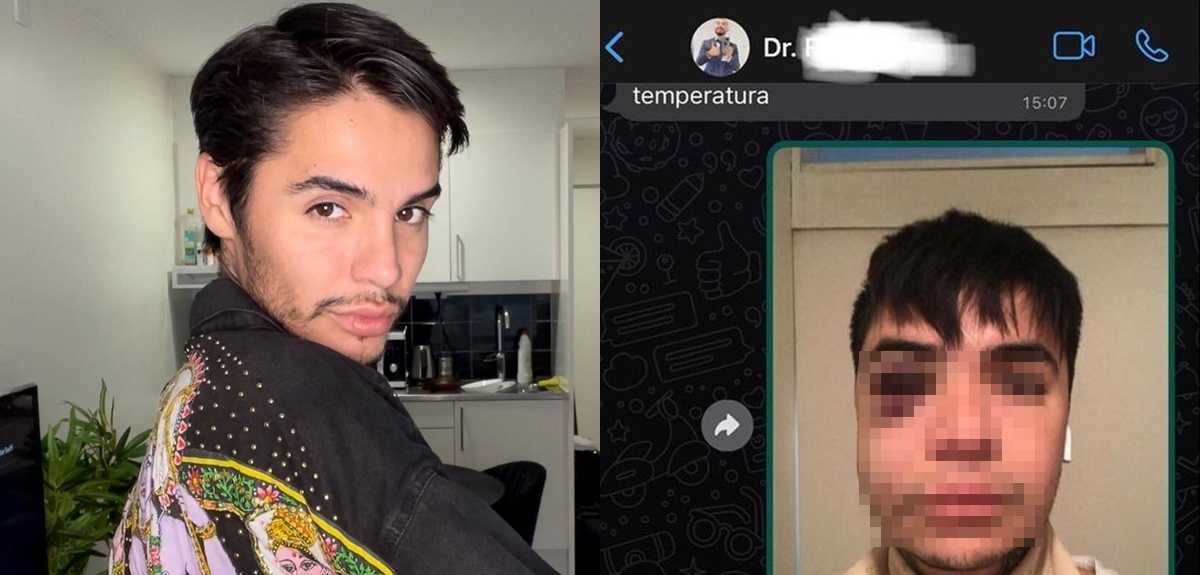 Clínica estética respondió a Leo Méndez por supuesta negligencia: él reaccionó con más pruebas