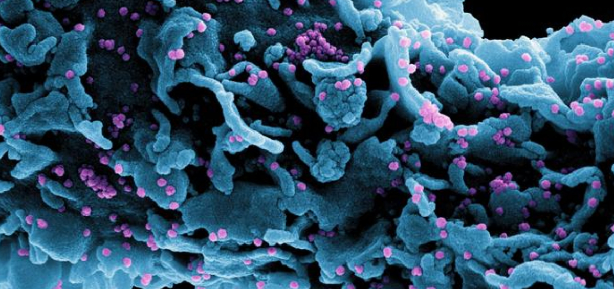 Descubren una nueva variante del coronavirus en Francia: se desconoce su peligrosidad y origen