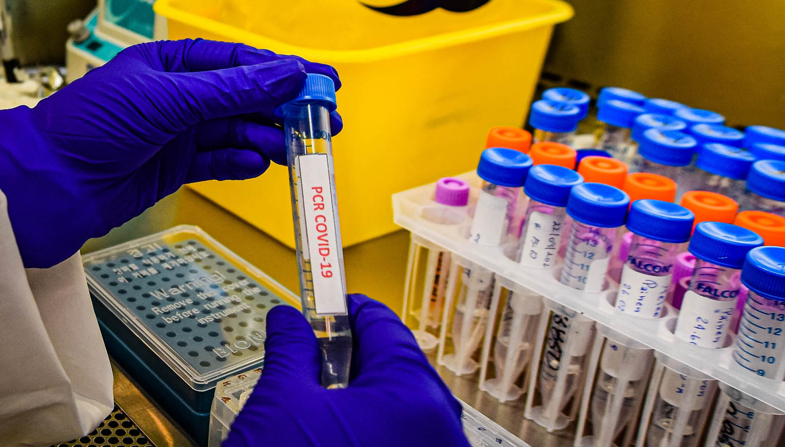 Informe ICOVID advierte aumento de hospitalizaciones ante impresionante alza de contagios