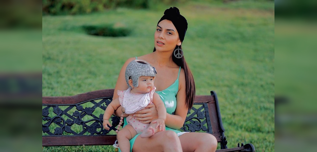 Kathy Contreras explicó la razón de salud por la que su hija usa casco: fotos llamaron la atención