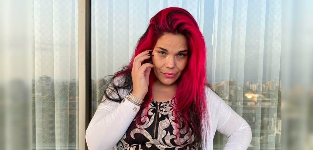 Zapallito Italiano se sometió a rejuvenecimiento facial: sorprendió mostrando el antes y después