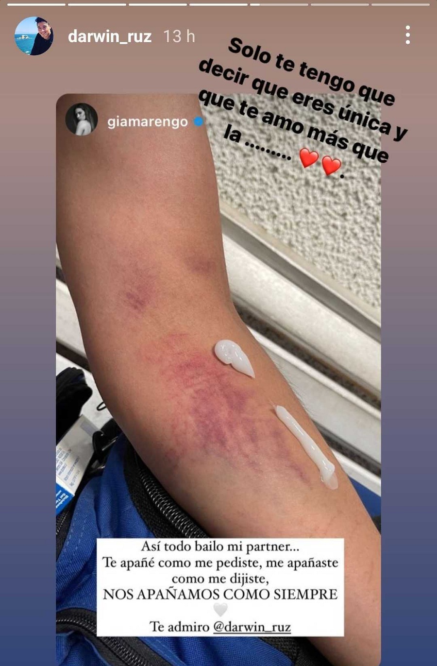 lesión Darwin Ruz