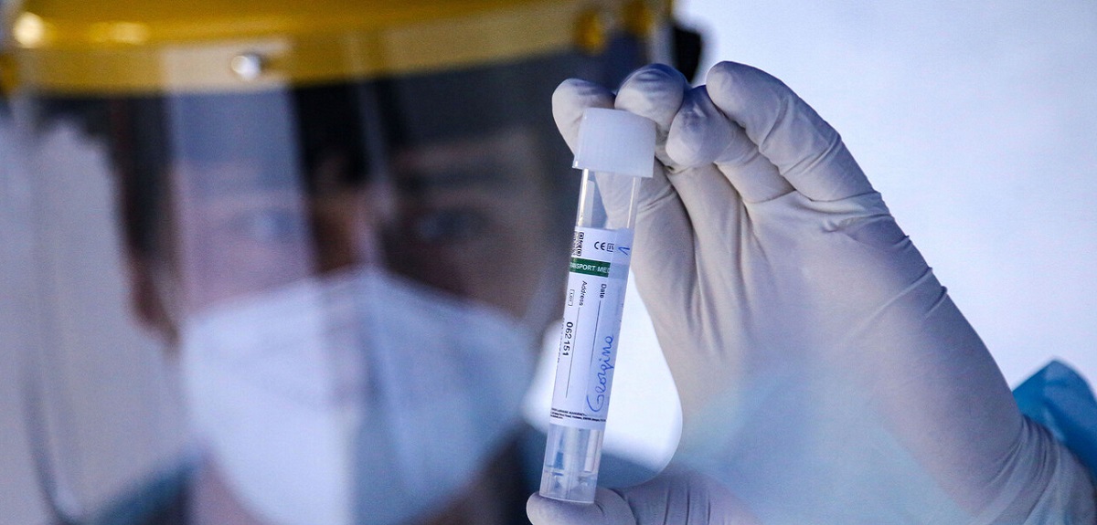 Minsal informó más de 36 mil casos nuevos de COVID-19 y registra 720 contagiados en UCI