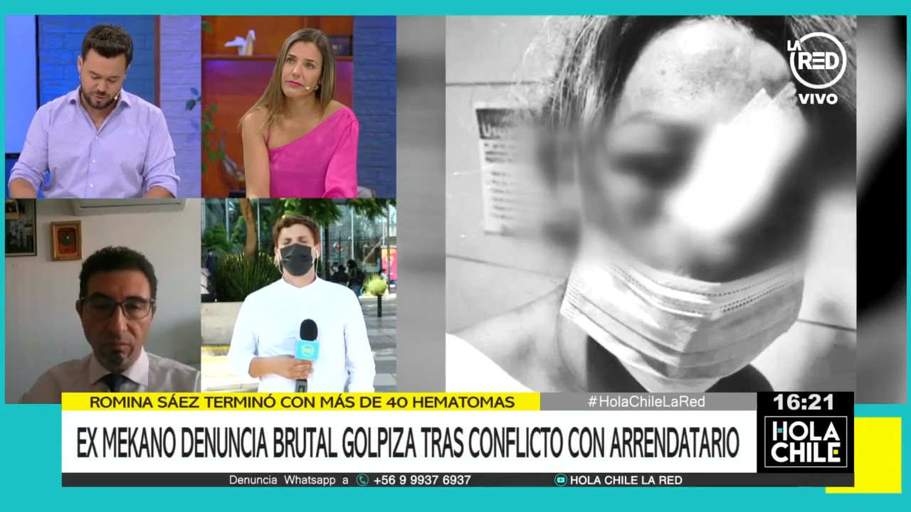 Familia de ex Mekano Romina Sáez acusó que fue víctima de brutal golpiza: recibió golpe con un bate