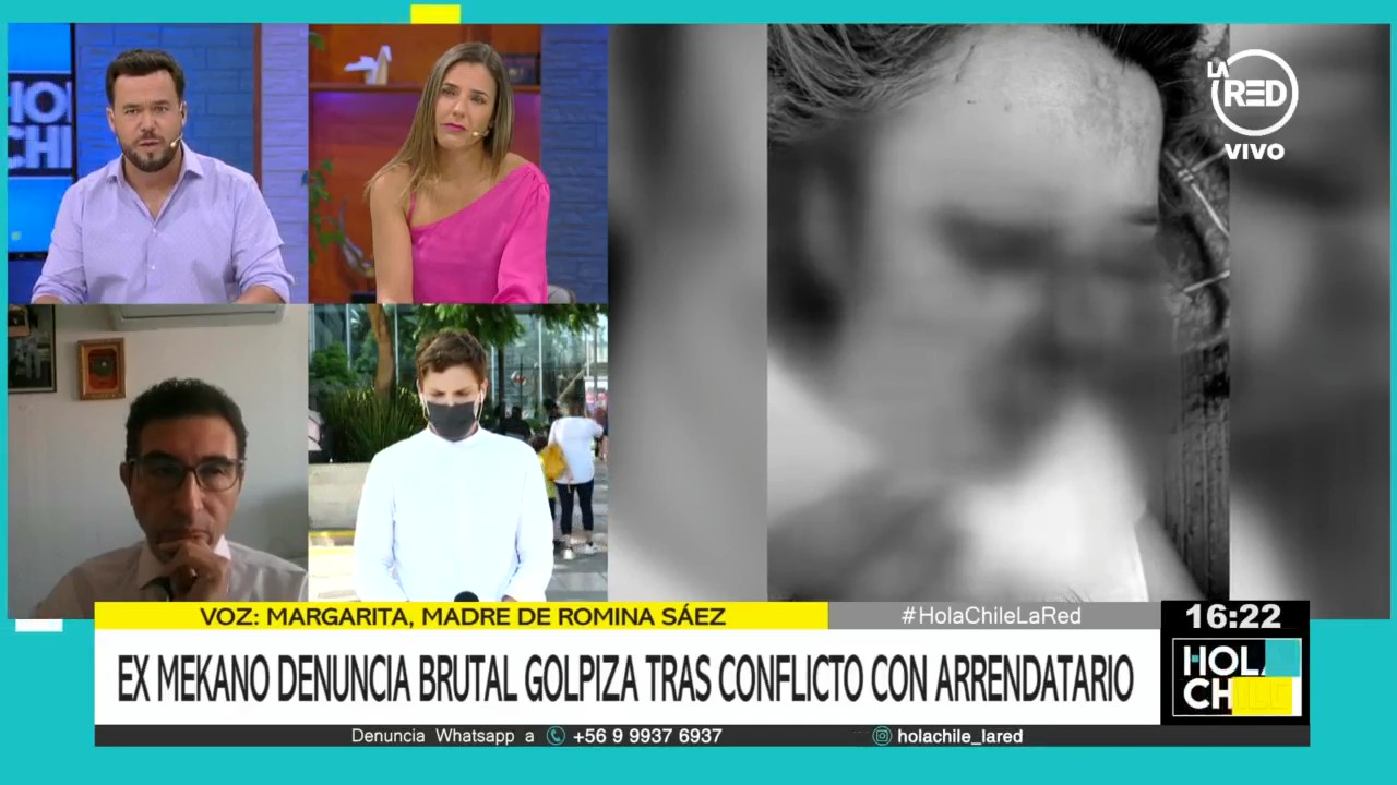 Familia de ex Mekano Romina Sáez acusó que fue víctima de brutal golpiza: recibió golpe con un bate