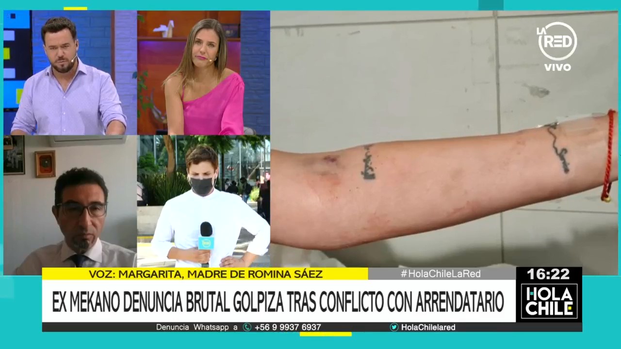 Familia de ex Mekano Romina Sáez acusó que fue víctima de brutal golpiza: recibió golpe con un bate