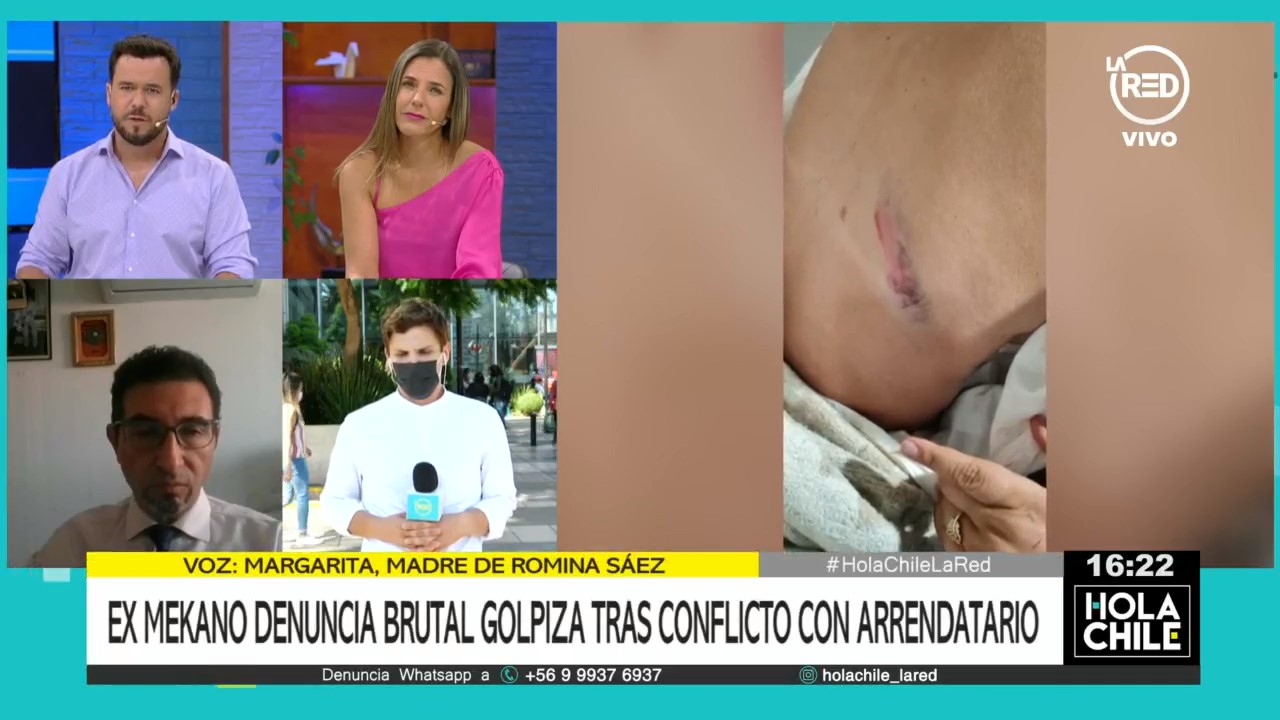 Familia de ex Mekano Romina Sáez acusó que fue víctima de brutal golpiza: recibió golpe con un bate