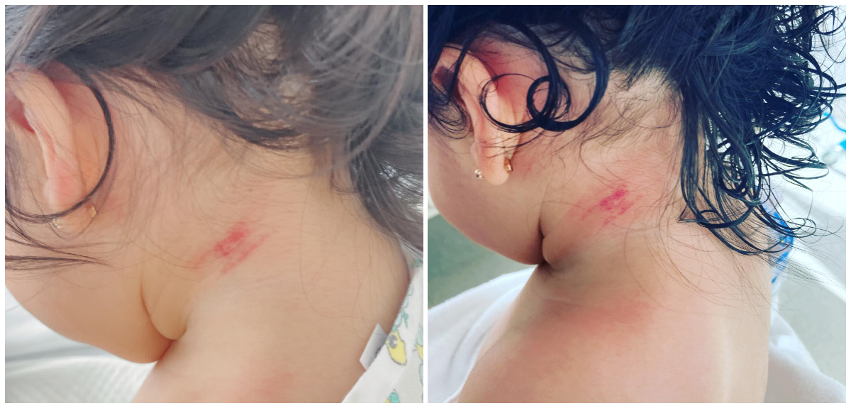 Madre denunció a clínica de Santiago: aseguró que su bebé resultó con lesiones tras baño