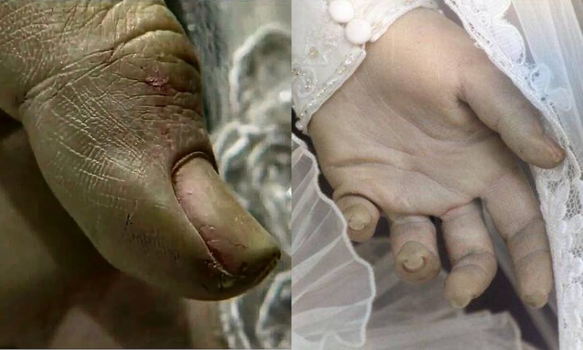 Manos de la Pascualita