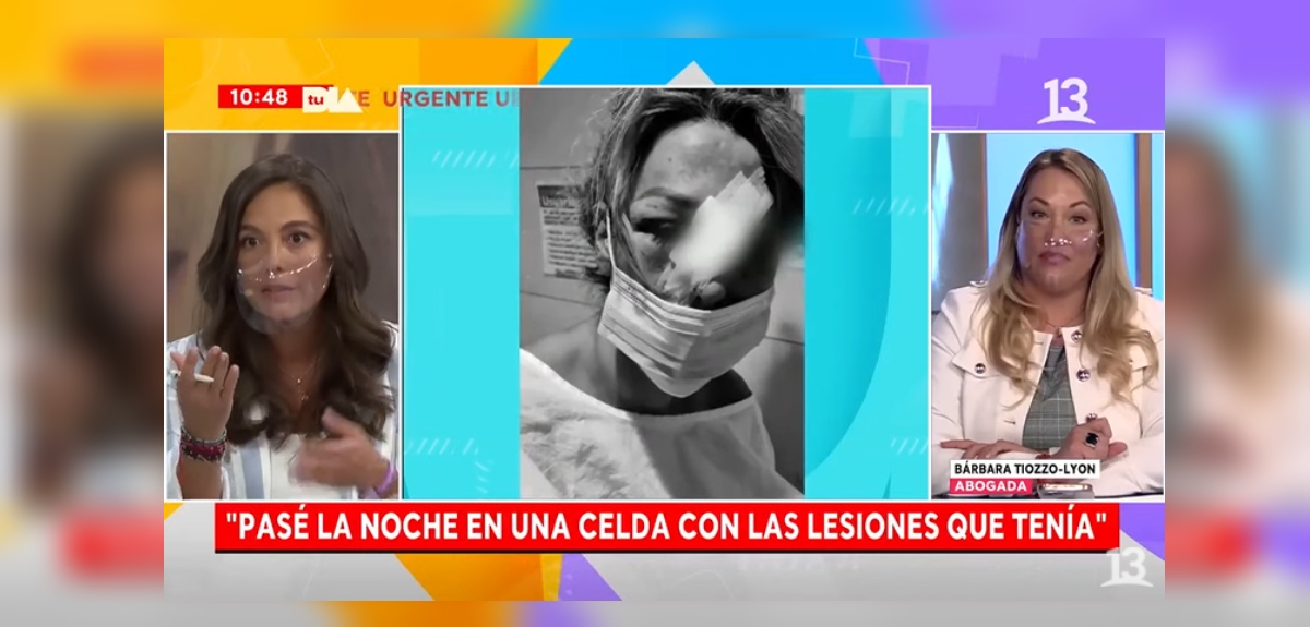 Romina Sáez ahondó en agresión