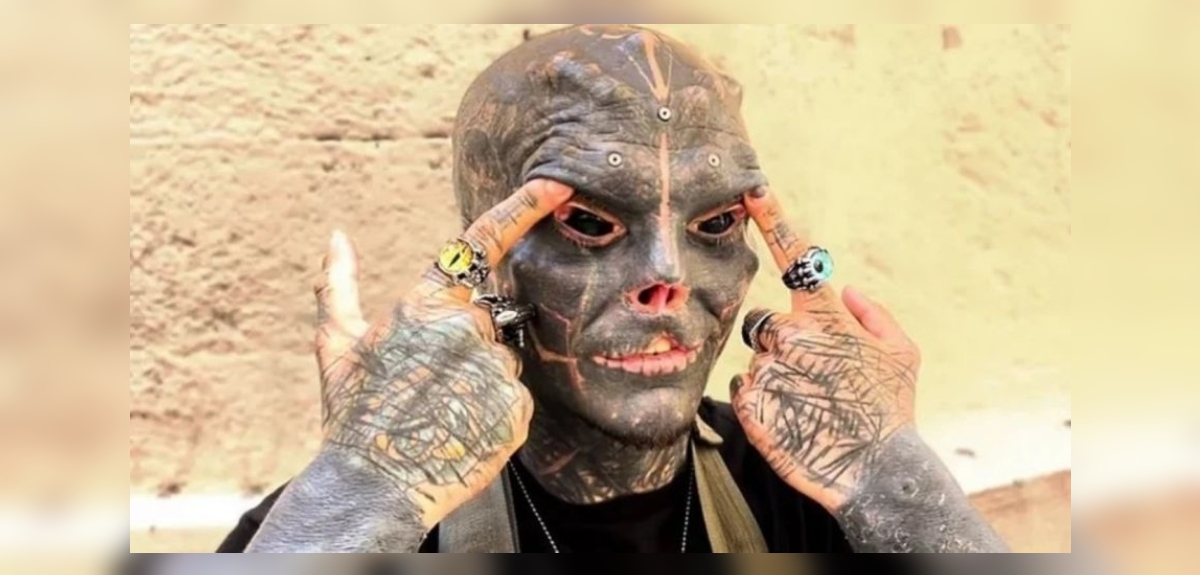 El hombre que busca ser un alien: se mutiló labios, orejas, nariz y ahora se amputará una pierna
