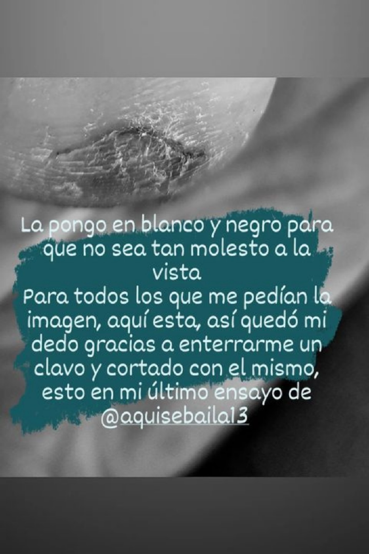 lesión Cata Palacios