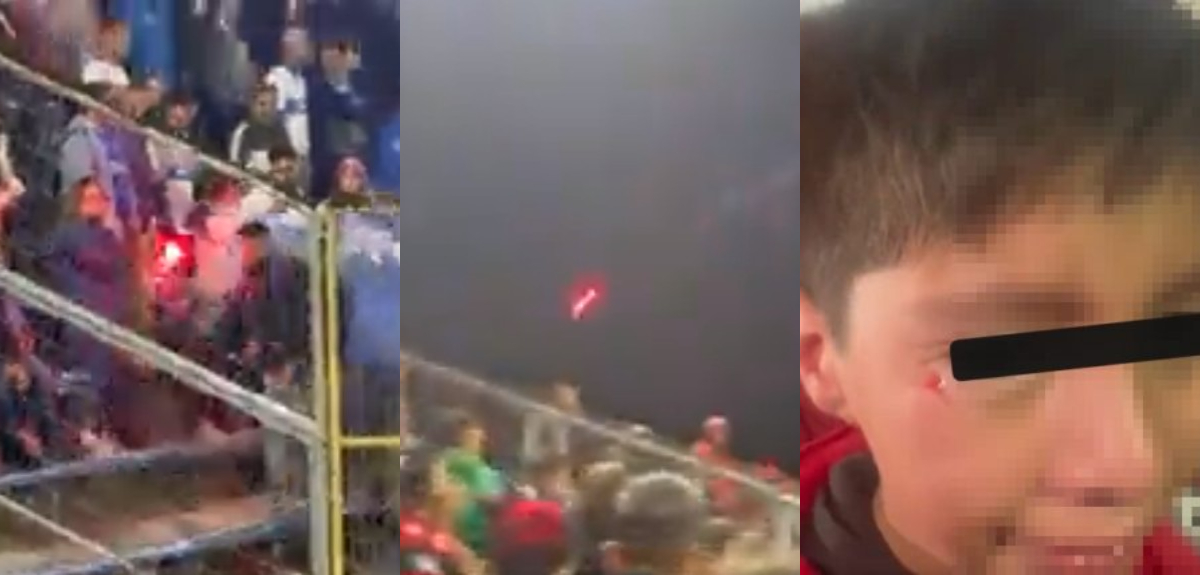 Madre de niño herido con bengala en duelo entre Flamengo y la UC:  