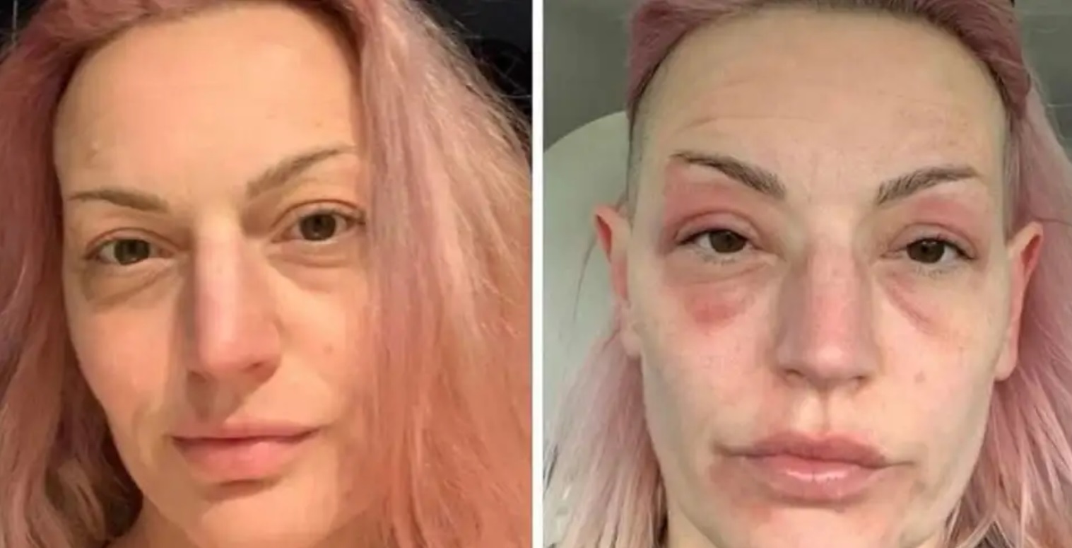 Mujer británica que recibió dosis de refuerzo