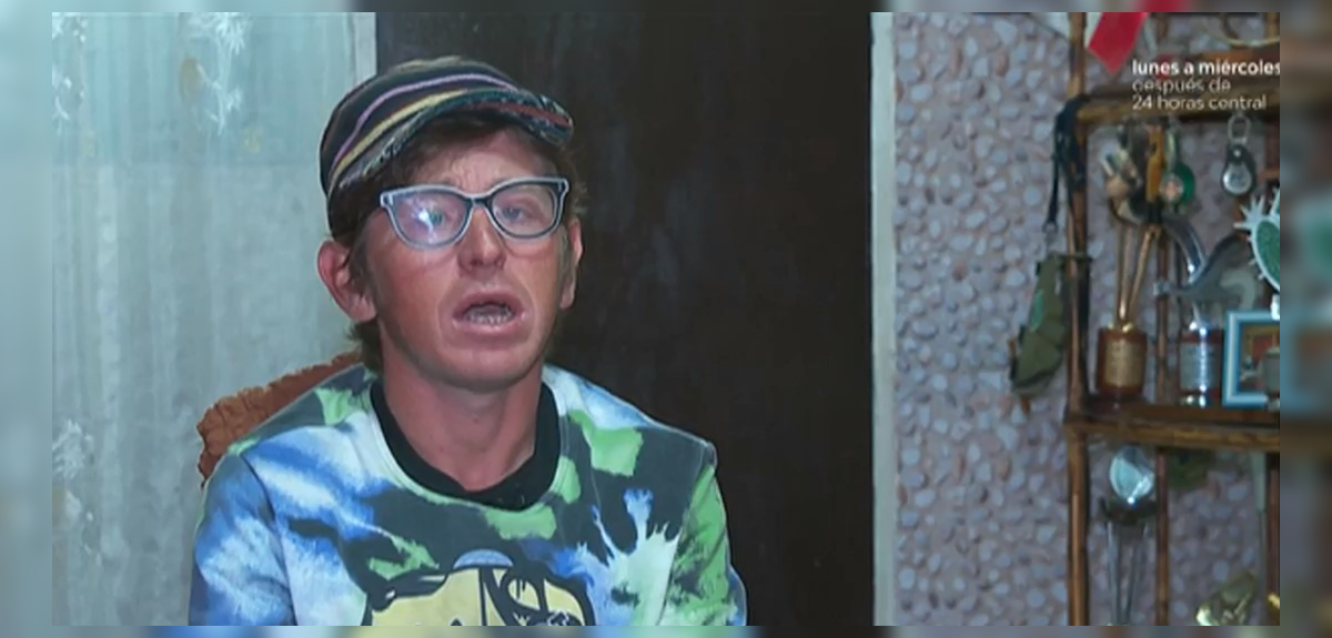 El complejo presente de Bastián Paz: comediante lucha con dura enfermedad que puede dañar la memoria