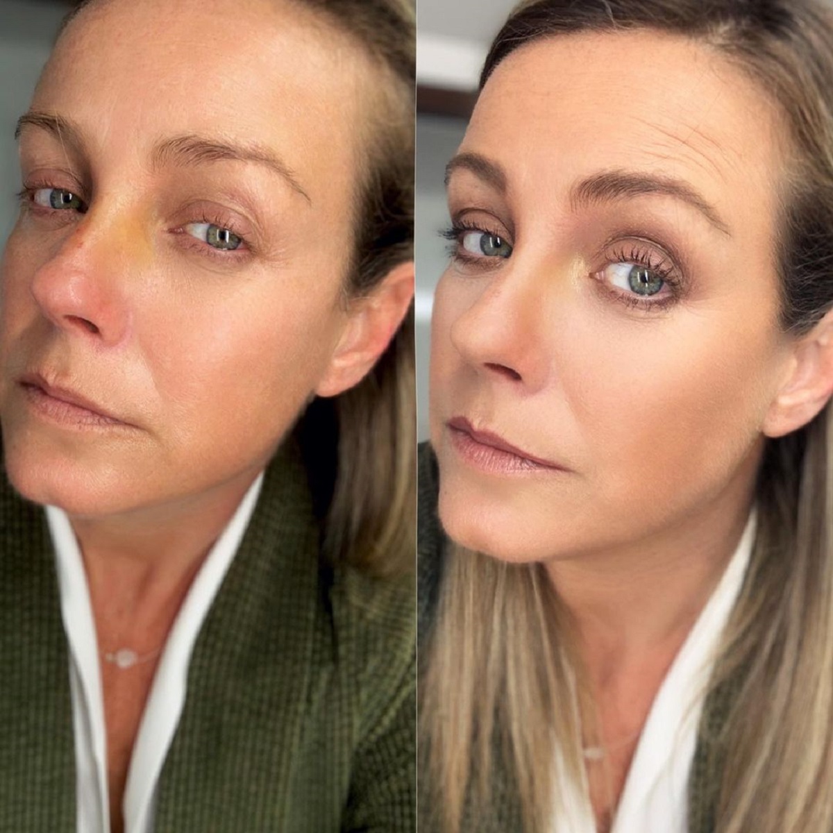 Claudia Conserva nariz