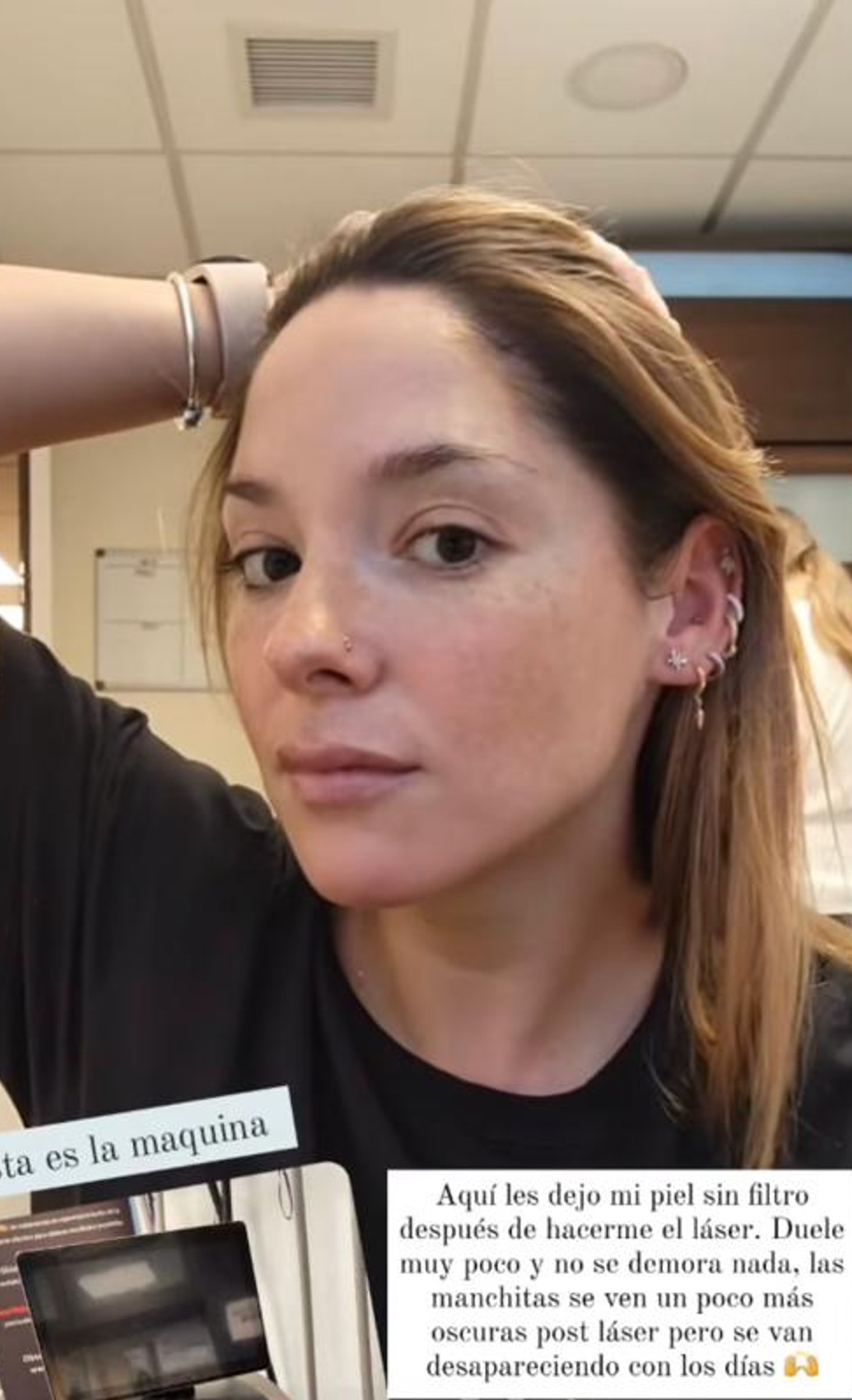 Kel Calderón sin filtro