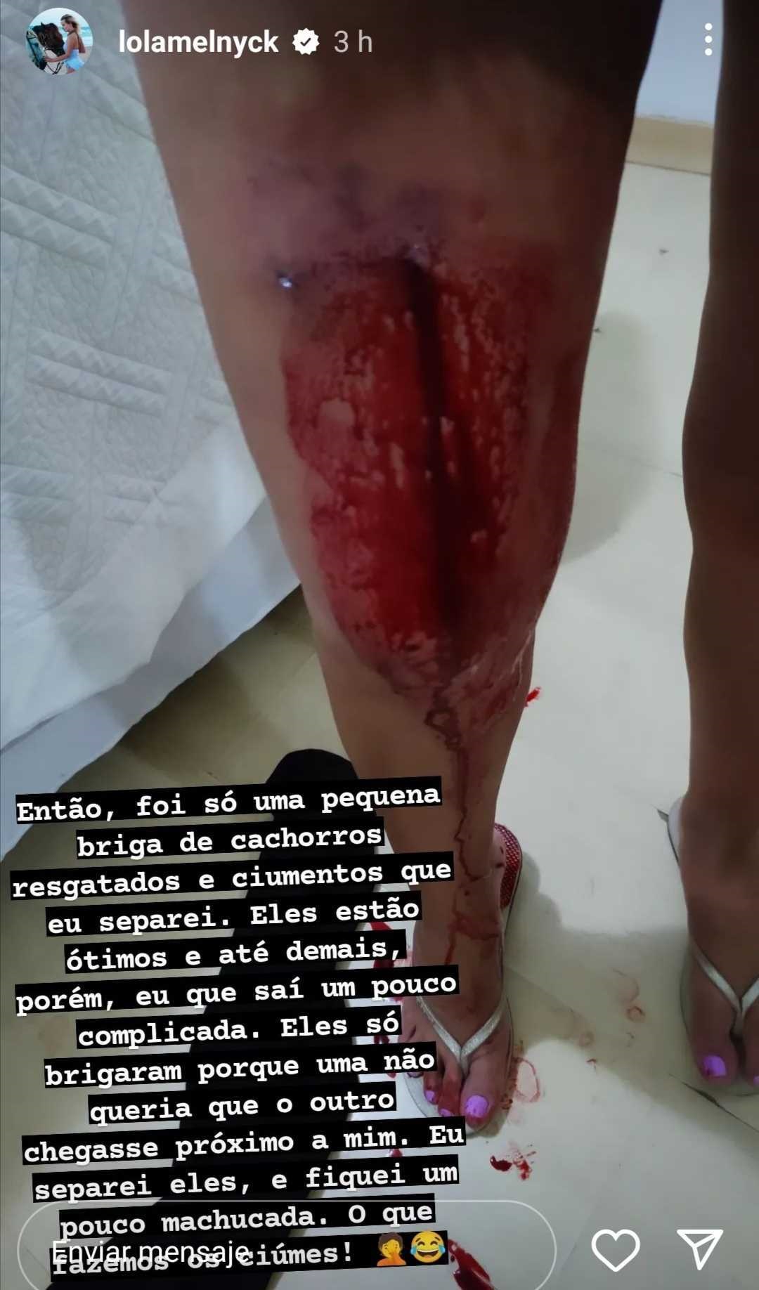 Lola Melnick heridas