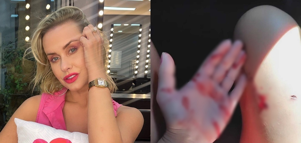 Lola Melnyck fue herida tras pelea de animales rescatados: mostró 