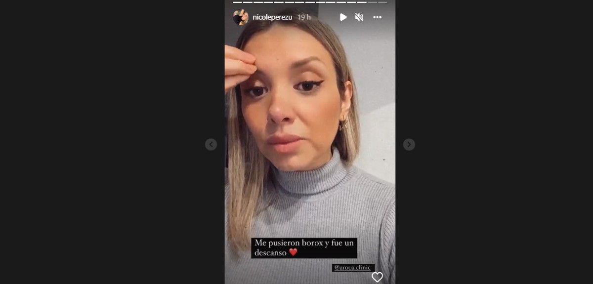 Nicole Pérez se sometió a una serie de procedimientos estéticos para cambiar su rostro: mostró los resultados 